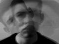 Does Toxoplasmosis Cause Schizophrenia?
